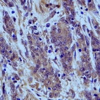 ERp5 Rabbit Polyclonal Antibody