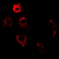 ERp5 Rabbit Polyclonal Antibody