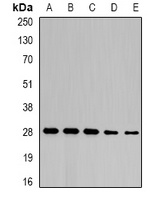 NFU1 Rabbit Polyclonal Antibody