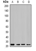 GTL3 Rabbit Polyclonal Antibody