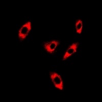 GTL3 Rabbit Polyclonal Antibody