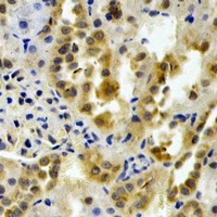 PTGES2 Rabbit Polyclonal Antibody