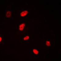 NSUN6 Rabbit Polyclonal Antibody