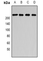 SMCHD1 Rabbit Polyclonal Antibody