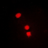 SMCHD1 Rabbit Polyclonal Antibody