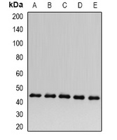 ACADS Rabbit Polyclonal Antibody