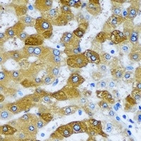 ACADS Rabbit Polyclonal Antibody