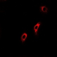 ACADS Rabbit Polyclonal Antibody