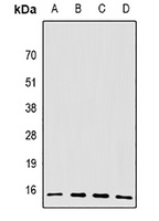 BRCC2 Rabbit Polyclonal Antibody