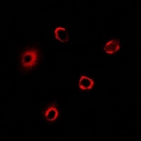 BRCC2 Rabbit Polyclonal Antibody