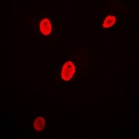 Brn-5 Rabbit Polyclonal Antibody