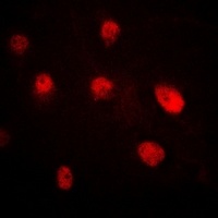 Pr-Set7 Rabbit Polyclonal Antibody