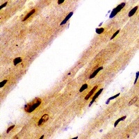 PSMB8 Rabbit Polyclonal Antibody