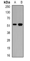 CALCOCO2 Rabbit Polyclonal Antibody