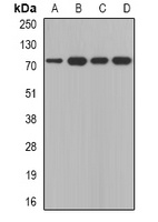 Calpain 5 Rabbit Polyclonal Antibody
