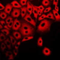 Calpain 5 Rabbit Polyclonal Antibody