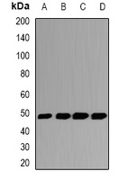 GSDML Rabbit Polyclonal Antibody
