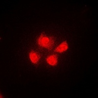 TUG Rabbit Polyclonal Antibody