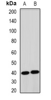 TERE1 Rabbit Polyclonal Antibody