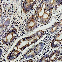 TERE1 Rabbit Polyclonal Antibody