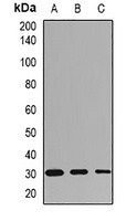 HLA-DRB1 Rabbit Polyclonal Antibody
