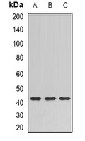 SULT2B1 Rabbit Polyclonal Antibody