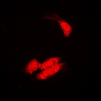 SULT2B1 Rabbit Polyclonal Antibody