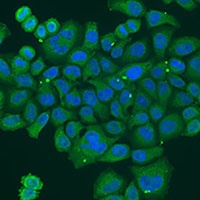 DPM1 Rabbit Polyclonal Antibody