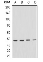 PSTPIP1 Rabbit Polyclonal Antibody