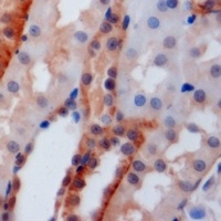 PSTPIP1 Rabbit Polyclonal Antibody