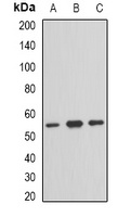 TFG Rabbit Polyclonal Antibody