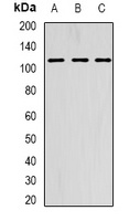 AARS2 Rabbit Polyclonal Antibody