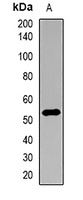 Nyctalopin Rabbit Polyclonal Antibody