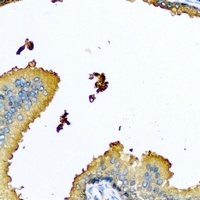Nyctalopin Rabbit Polyclonal Antibody