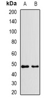 VPS37A Rabbit Polyclonal Antibody