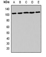 AlaRS Rabbit Polyclonal Antibody