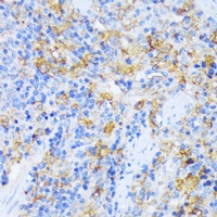 AlaRS Rabbit Polyclonal Antibody
