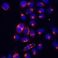 AlaRS Rabbit Polyclonal Antibody