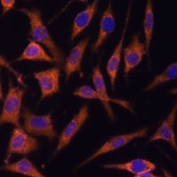 ACAT2 Antibody