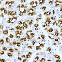 H-Ras Antibody