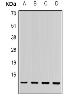 SSNA1 Rabbit Polyclonal Antibody
