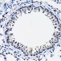 SSNA1 Rabbit Polyclonal Antibody