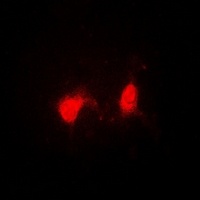 SSNA1 Rabbit Polyclonal Antibody