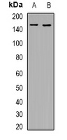 KDM4A Rabbit Polyclonal Antibody