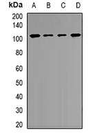MTHFD1L Rabbit Polyclonal Antibody
