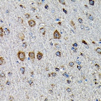 MTHFD1L Rabbit Polyclonal Antibody