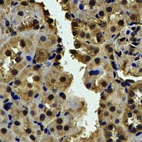 CALCOCO1 Antibody