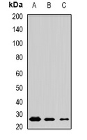 MSRB3 Rabbit Polyclonal Antibody