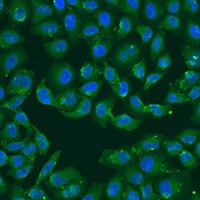 MSRB3 Rabbit Polyclonal Antibody