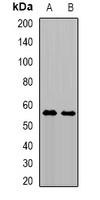TRMT61B Antibody